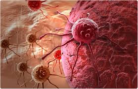Cancer Detection Using Deep Learning